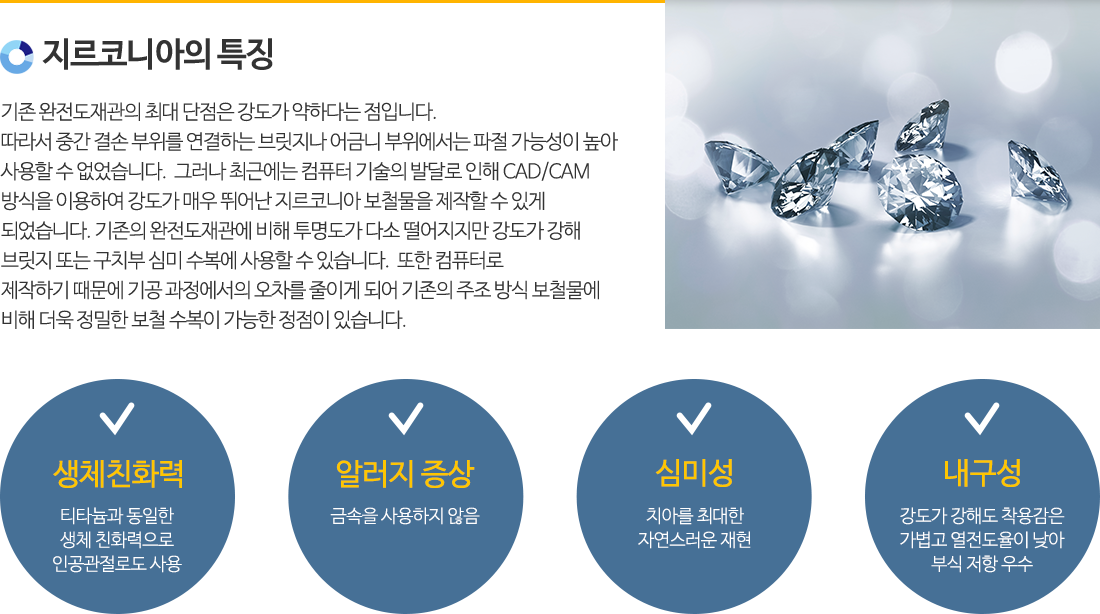 올세라믹/지르코니아특징